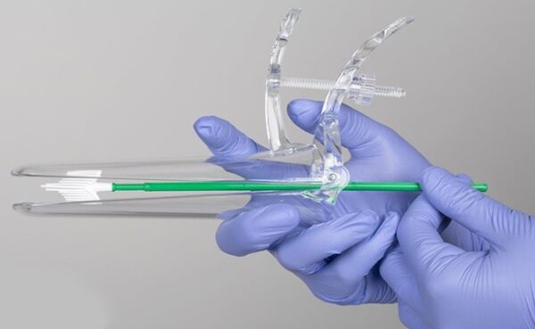 زگیل تناسلی